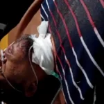 Driver Taksi Online di Medan Dibegal Penumpang Leher Digorok
